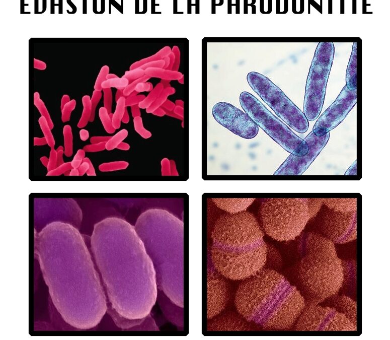 Infection buccodentaire : ne la laissez pas gagner du terrain !